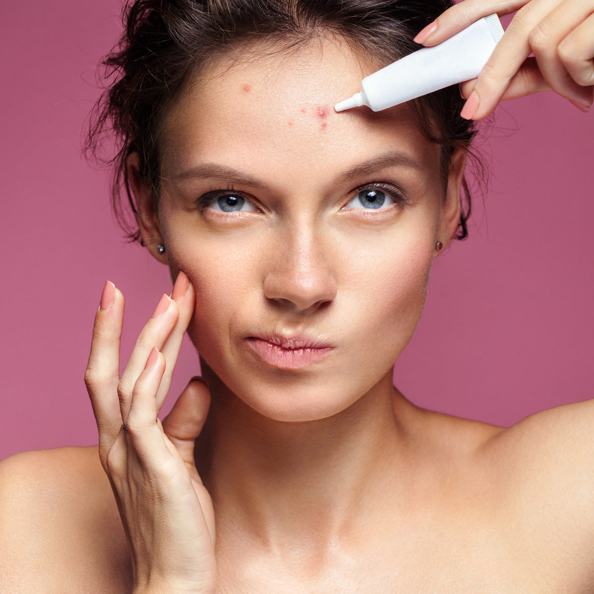 Acne Prevention Tips To Help You Get Clear Skin