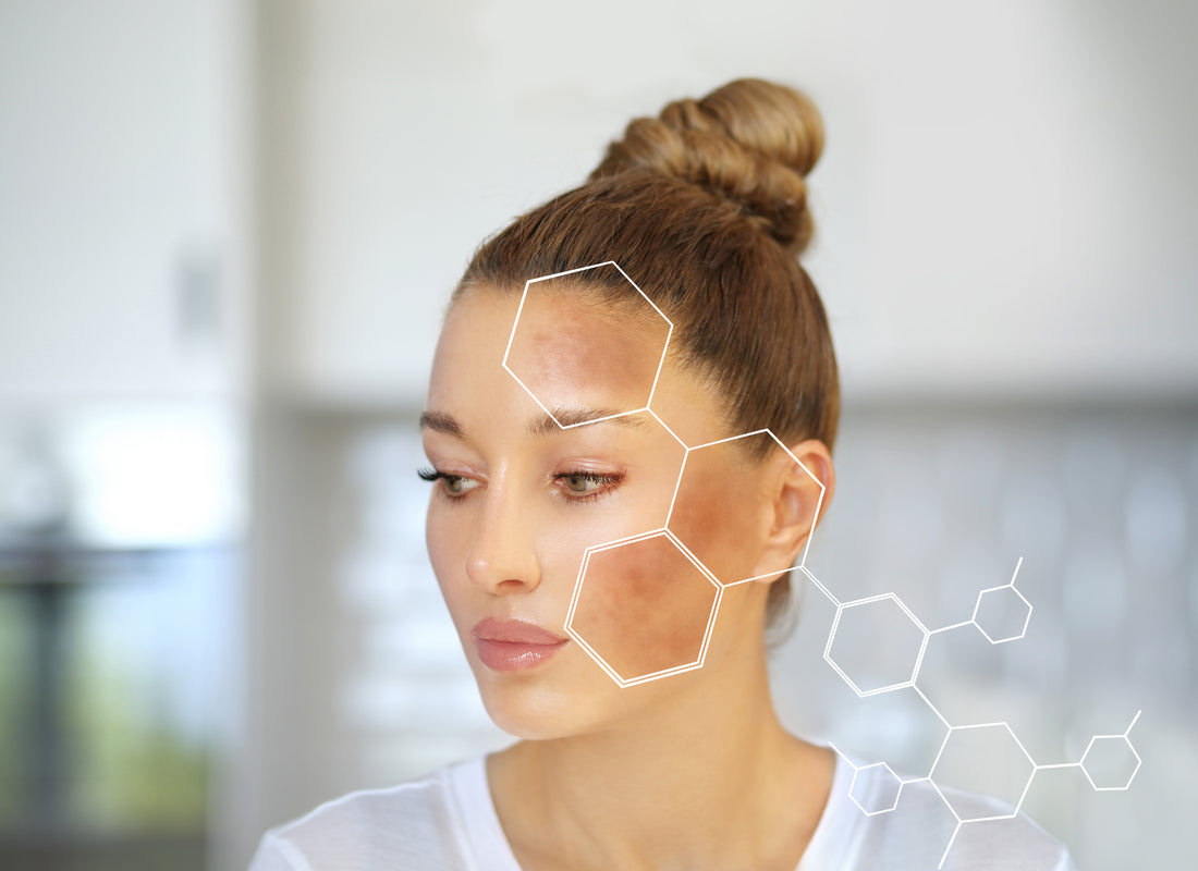 How Do You Remove Dark Spots On The Face Cure Aqua Gel Official Site